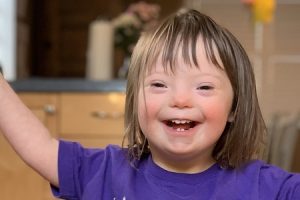 3 Tips Terapi Khusus untuk Anak Down Syndrome